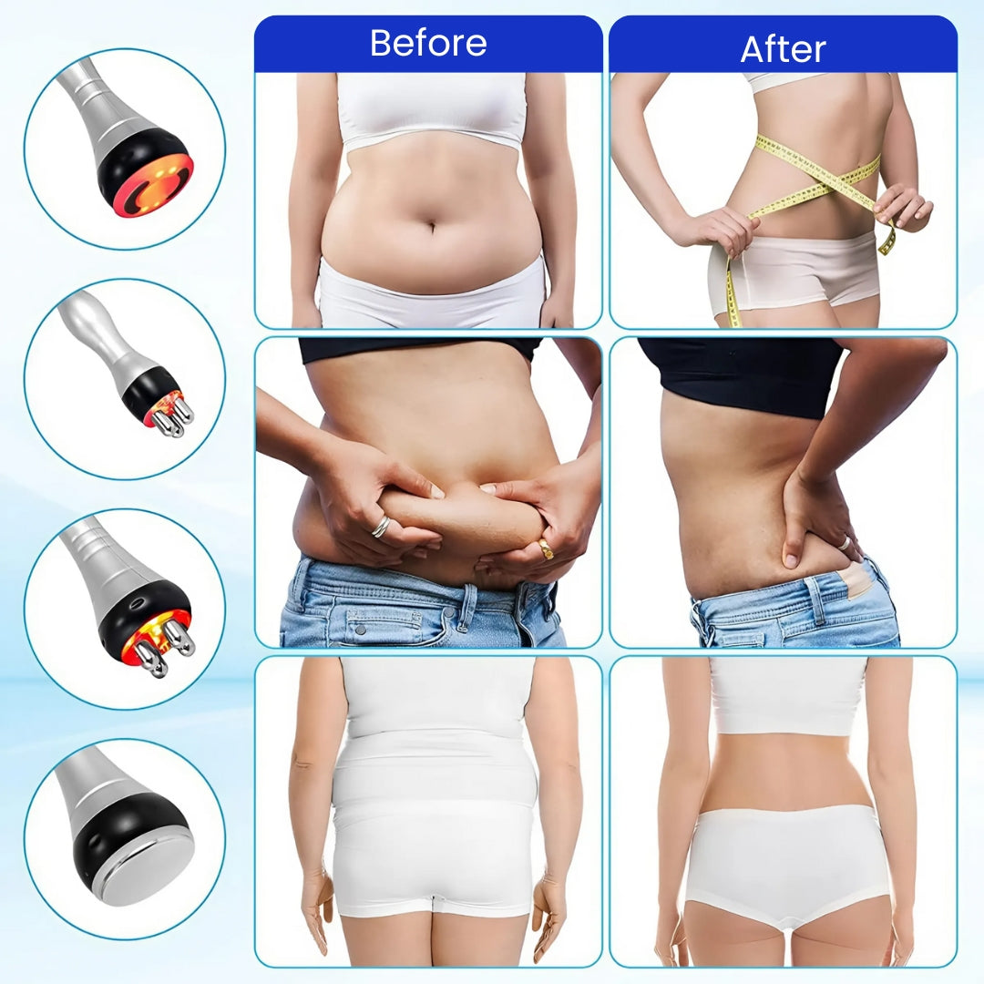 FatBlaster Ultrasonic Cavitation Machine